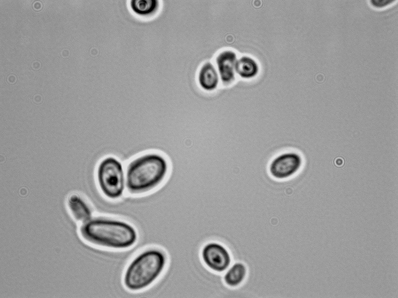 Candida parapsilosis